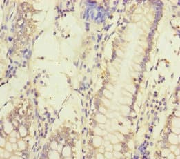MCCC1 Antibody