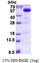 Human PIP4K2B Protein (Recombinant His)