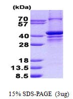 Human PARP2 Protein (Recombinant His)