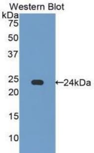 CASP7 / Caspase 7 Antibody (aa24-198)