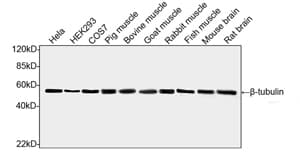 IHC-plus™ Beta Tubulin Antibody (clone 2G7D4)