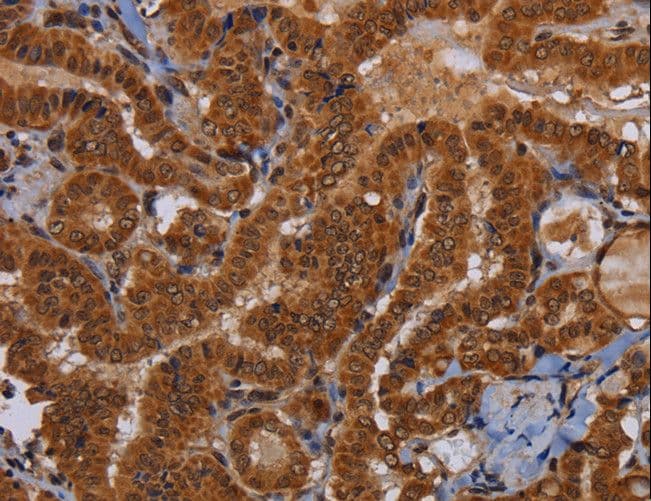 Polyclonal Rabbit anti-Human WDR83 Antibody (IHC)