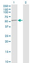 Monoclonal Mouse anti-Human TP53 / p53 Antibody (clone 2C3, IF, WB)