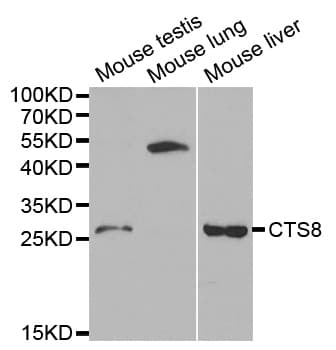 Polyclonal Rabbit anti-Human CST8 / CRES Antibody (IHC, IF, WB)