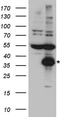 CTRL Antibody