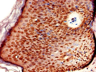 Endogenous Retrovirus HERV-K10 putative protease Antibody