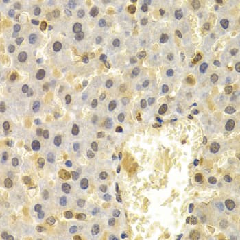 FAT10 / UBD Antibody