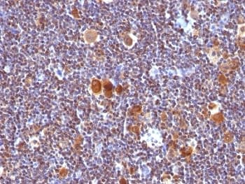 BAX Antibody (aa3-16, clone SPM336)