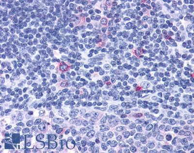 PathPlus™ CCR7 Antibody (C-Terminus)