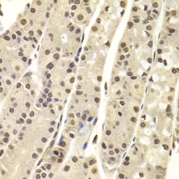 DNTT / TdT Antibody
