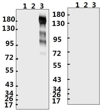 SARS-CoV-2 Spike Glycoprotein Antibody (aa 245-260)