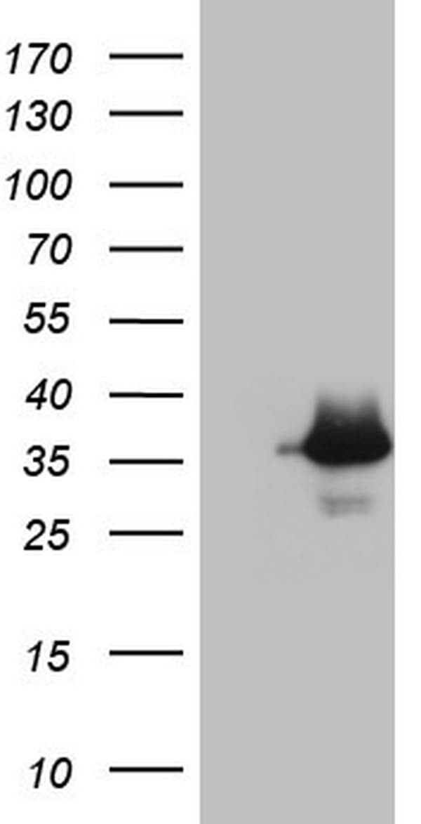 ASPA Antibody (aa77-313, clone OTI2D2)