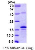 Human GREM2 / Gremlin 2 Protein (Recombinant His)