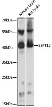 Polyclonal Rabbit anti-Human SEPT12 / Septin 12 Antibody (WB)