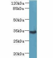 IHC-plus™ Polyclonal Rabbit anti-Human ZDHHC3 Antibody (IHC, WB)