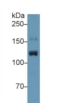 ITIH4 Antibody (aa29-157)