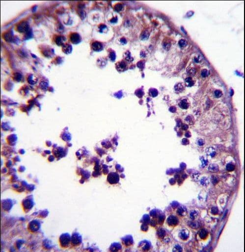 TSNAX / TRAX Antibody (aa34-62)