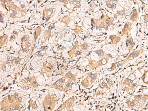 TNNT1 / TNT Antibody