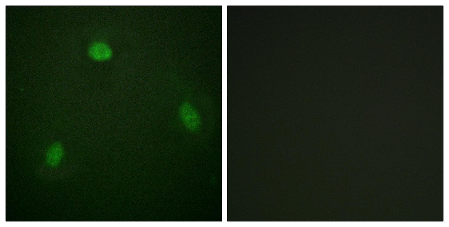 Polyclonal Rabbit anti-Human PIN1 Antibody (Ab-1619, IHC, IF)