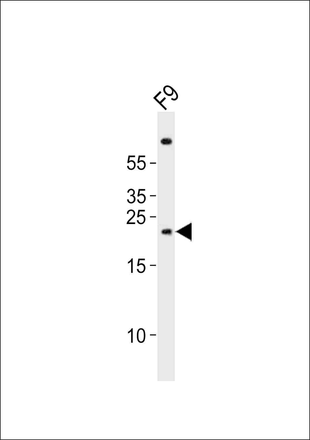 CLDN6 / Claudin 6 Antibody (aa146-180)
