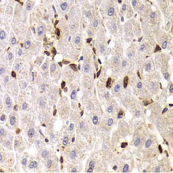 SPN / CD43 Antibody