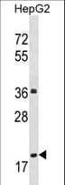 Polyclonal Rabbit anti-Human PPM1M Antibody (aa130-158, WB)