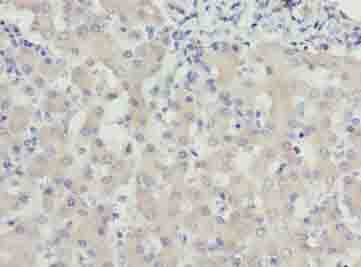 Polyclonal Rabbit anti-Human WDR91 Antibody (IHC)
