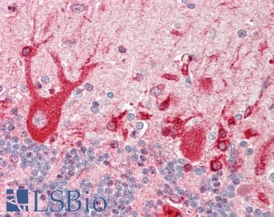 IHC-plus™ Polyclonal Rabbit anti-Human MAP4 Antibody (aa1102-1152, IHC, WB)