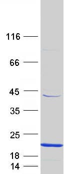 Human CD247 / CD3 Zeta Protein (Recombinant Myc-DDK (Flag))