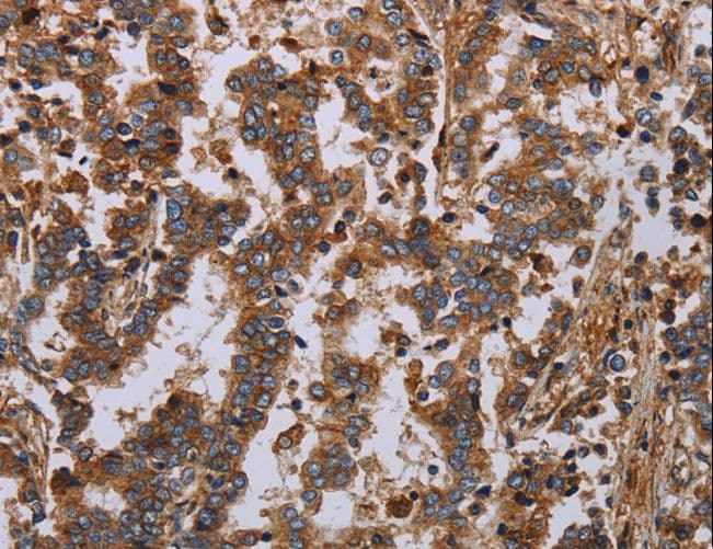 GDF2 / BMP9 Antibody (aa413-425)