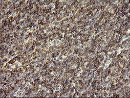 SERPINB3 Antibody (clone OTI1G9)