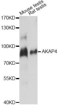 Polyclonal Rabbit anti-Human AKAP82 / AKAP4 Antibody (WB)