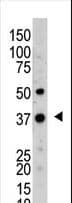 UCHL5 / UCH37 Antibody (aa56-87)
