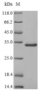 Rabbit SAA1 / SAA / Serum Amyloid A Protein (Recombinant 10His-SUMO, N-terminus + Myc, C-terminus)