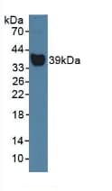 HP / Haptoglobin Antibody (aa70-332)