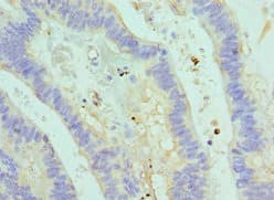 Polyclonal Rabbit anti-Human ASMTL Antibody (aa1-290, IHC, WB)