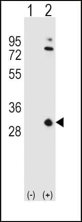 Polyclonal Rabbit anti-Human APOA1 / Apolipoprotein A 1 Antibody (aa10-37, IHC, WB)