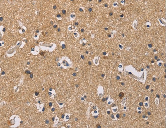 Polyclonal Rabbit anti-Human GB5 / GNB5 Antibody (IHC, WB)