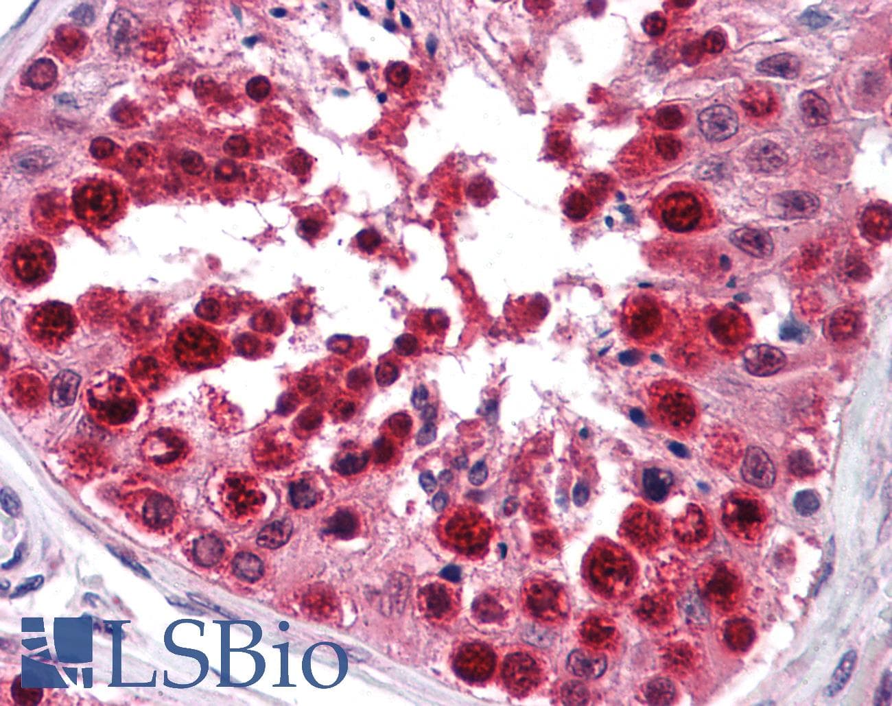 IHC-plus™ HNRNP-E2 / PCBP2 Antibody (clone 5F12)