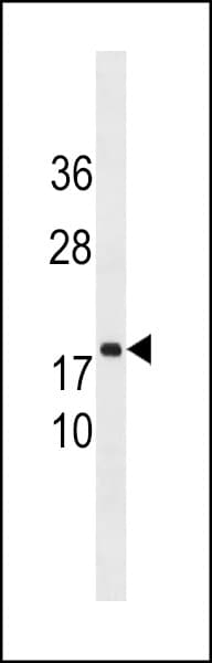 Polyclonal Rabbit anti-Human C8orf44 Antibody (aa118-146, WB)