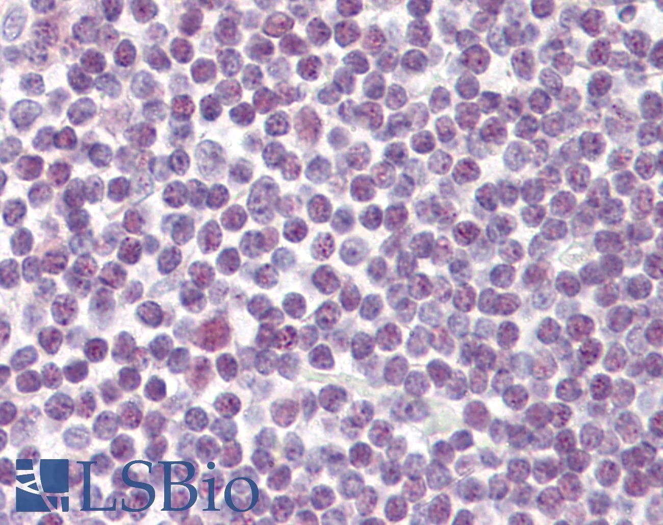 IHC-plus™ DDX18 Antibody (aa20-70)