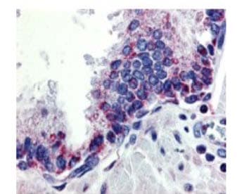 TNFSF13 / APRIL Antibody (aa180-230)