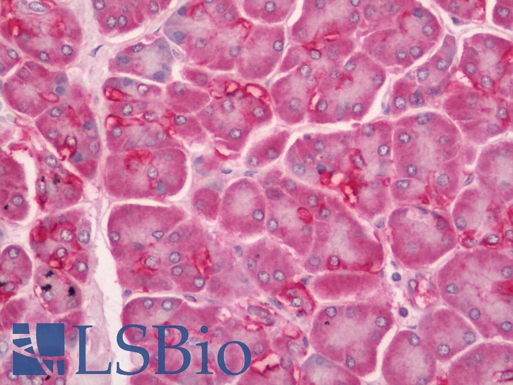 IHC-plus™ TARSH / ABI3BP Antibody