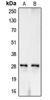 CA1 / Carbonic Anhydrase I Antibody (Internal)