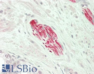IHC-plus™ PEAK1 / SGK269 Antibody (aa95-144)