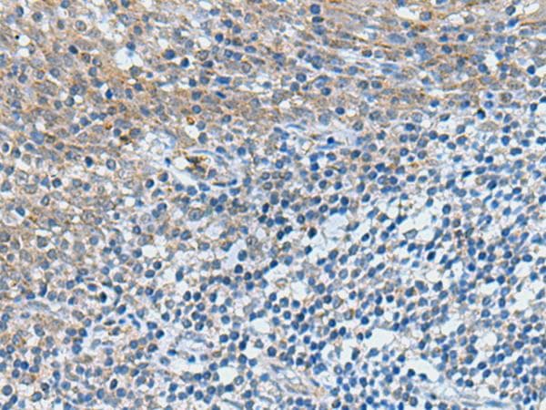 KIAA1434 protein Antibody
