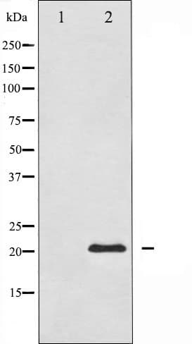 Polyclonal Rabbit anti-Human BIRC5 / Survivin Antibody (IHC, IF, WB)