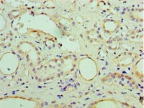 CRYAB / Alpha B Crystallin Antibody (aa1-175)