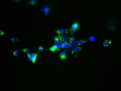 Polyclonal Rabbit anti-Human SLC25A51 / MCART1 Antibody (WB)