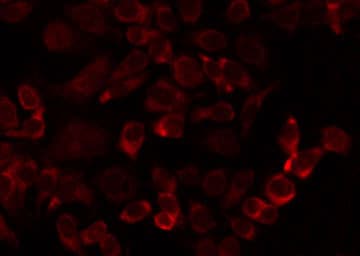 Polyclonal Rabbit anti-Human MRPL24 Antibody (IHC, IF, WB)
